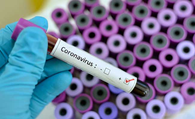 fuga coronavirus